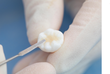 Load image into Gallery viewer, TrusFIL Universal Composite Restorative