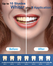 Load image into Gallery viewer, MySmile Teeth Whitening Kit with 5-LED Light 3x3ml PAP Teeth Whitening Gel Syginges, Non Sensitive Whitening Gel Refill Pack Tooth Whitener