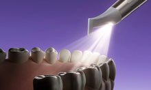 Load image into Gallery viewer, Woodpecker PT-E Dental Air Flow Polisher & Ultrasonic Scaler Dual Heating System