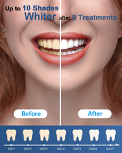 Load image into Gallery viewer, MySmile 3pc 35% Carbamide Peroxide Teeth Whitening Gels Refill Pack