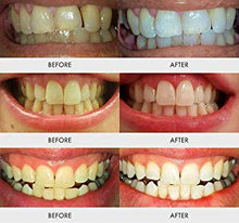 Load image into Gallery viewer, mysmile