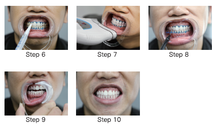 Load image into Gallery viewer, zoom teeth whitening