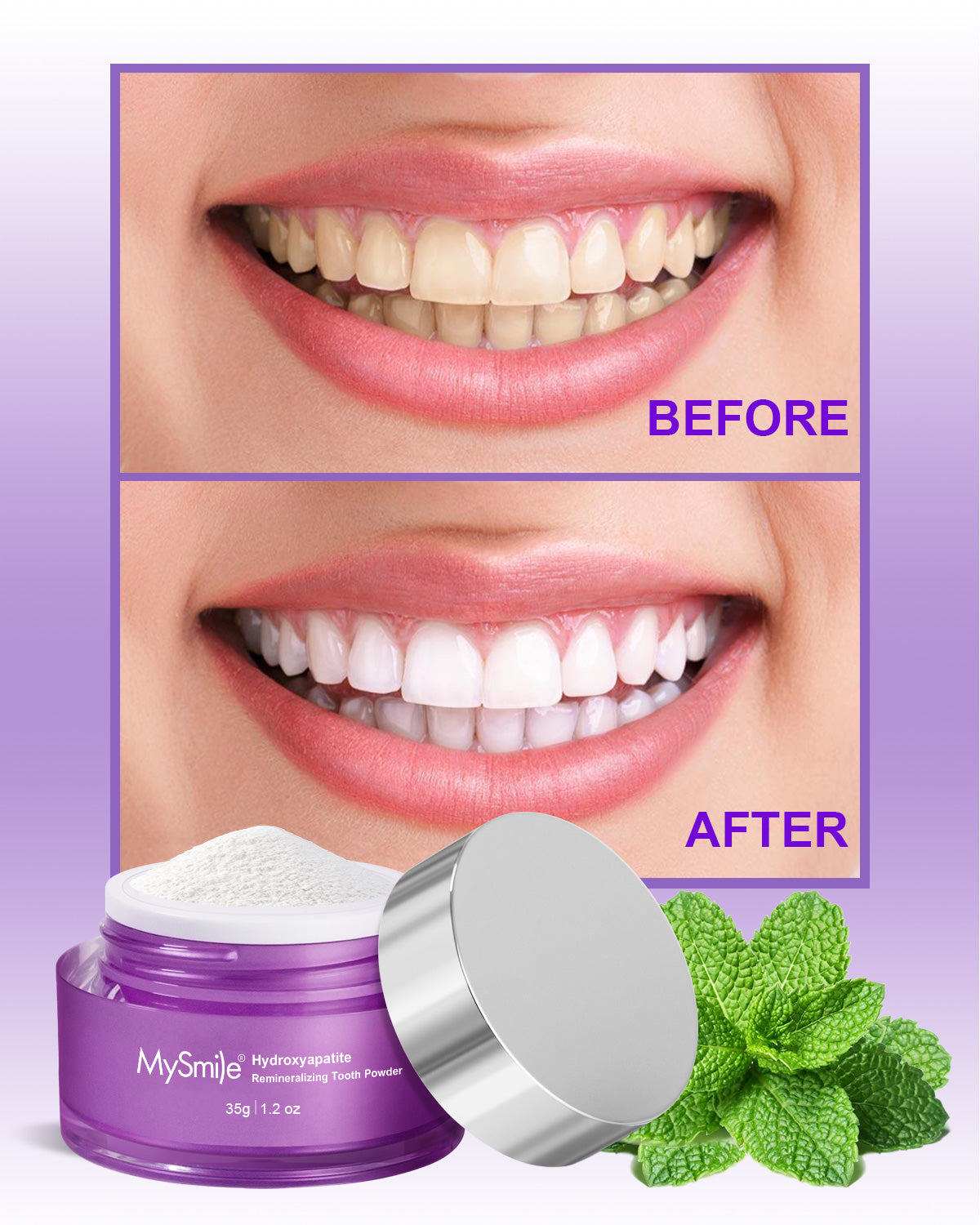 MySmile Hydroxyapatite Teeth Whitening Powder Kit Remove Stains