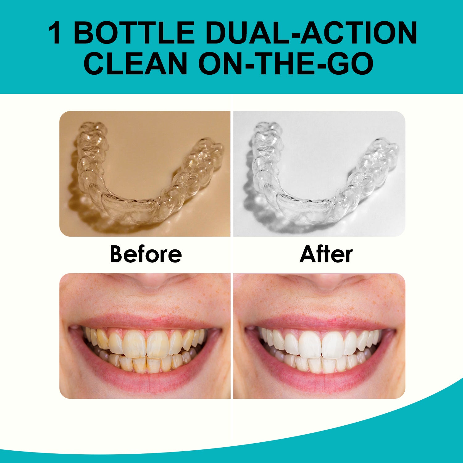 MySmile Aligner & Retainer Cleaner Foam for Invisalign, Mouth Guards, Night Guards, Veneers, Whitens Teeth, Kills Germs, Fights Bad Breath, Travel-Friendly, Fresh Mint