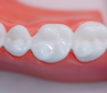 Load image into Gallery viewer, Proseal F Enamel Coating Resin
