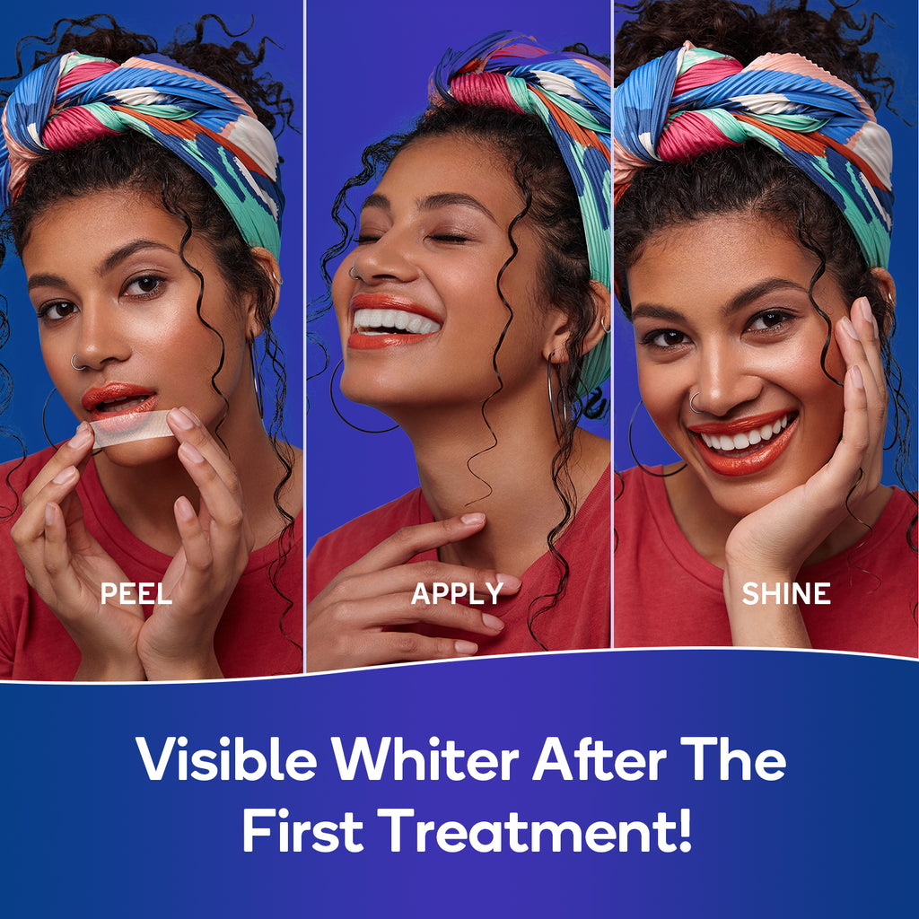 MySmile 10pcs 5 Treatment 20%CP Teeth Whitening Strips 1 Week Tooth Whitener Kit