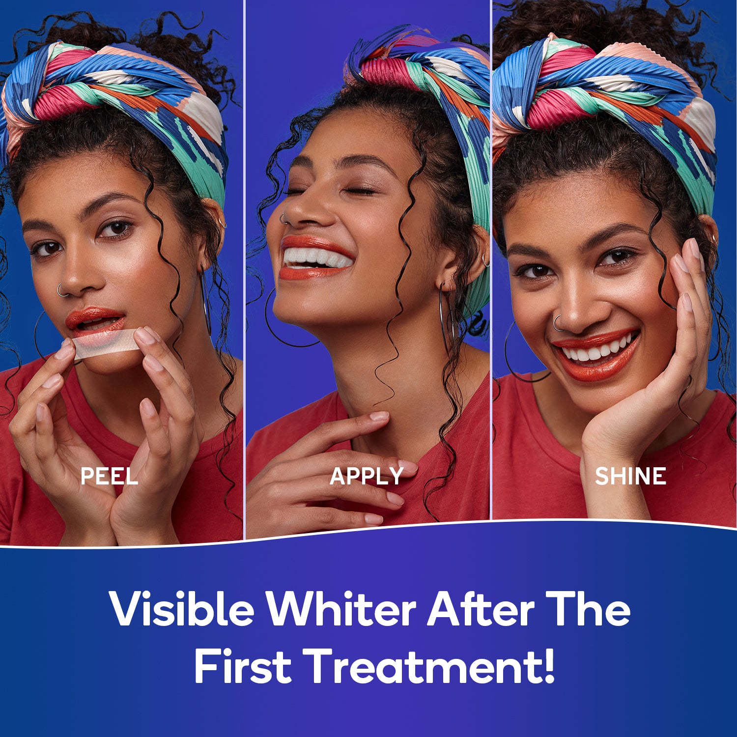 MySmile 10pcs 5 Treatment 20%CP Teeth Whitening Strips 1 Week Tooth Whitener Kit