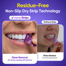 Load image into Gallery viewer, MySmile 28pcs 14 Treatment Purple Teeth Whitening Strips 2 Weeks Tooth Whitener Kit
