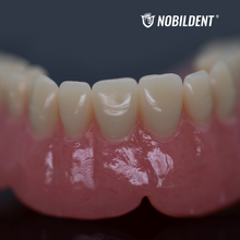 Load image into Gallery viewer, Denture Base Polymer &amp; Liquid
