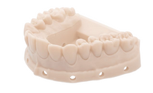 Load image into Gallery viewer, HUGE Dental Model Resin M3.0 (Almond)
