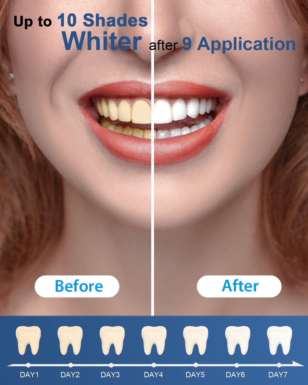 MySmile 2pc 8ml Teeth Whitening Pen Kit,22%CP Teeth Whitening Gel Refill Removes Years Tooth Stains Tooth Whitener 35 Treatments Non Sensitive