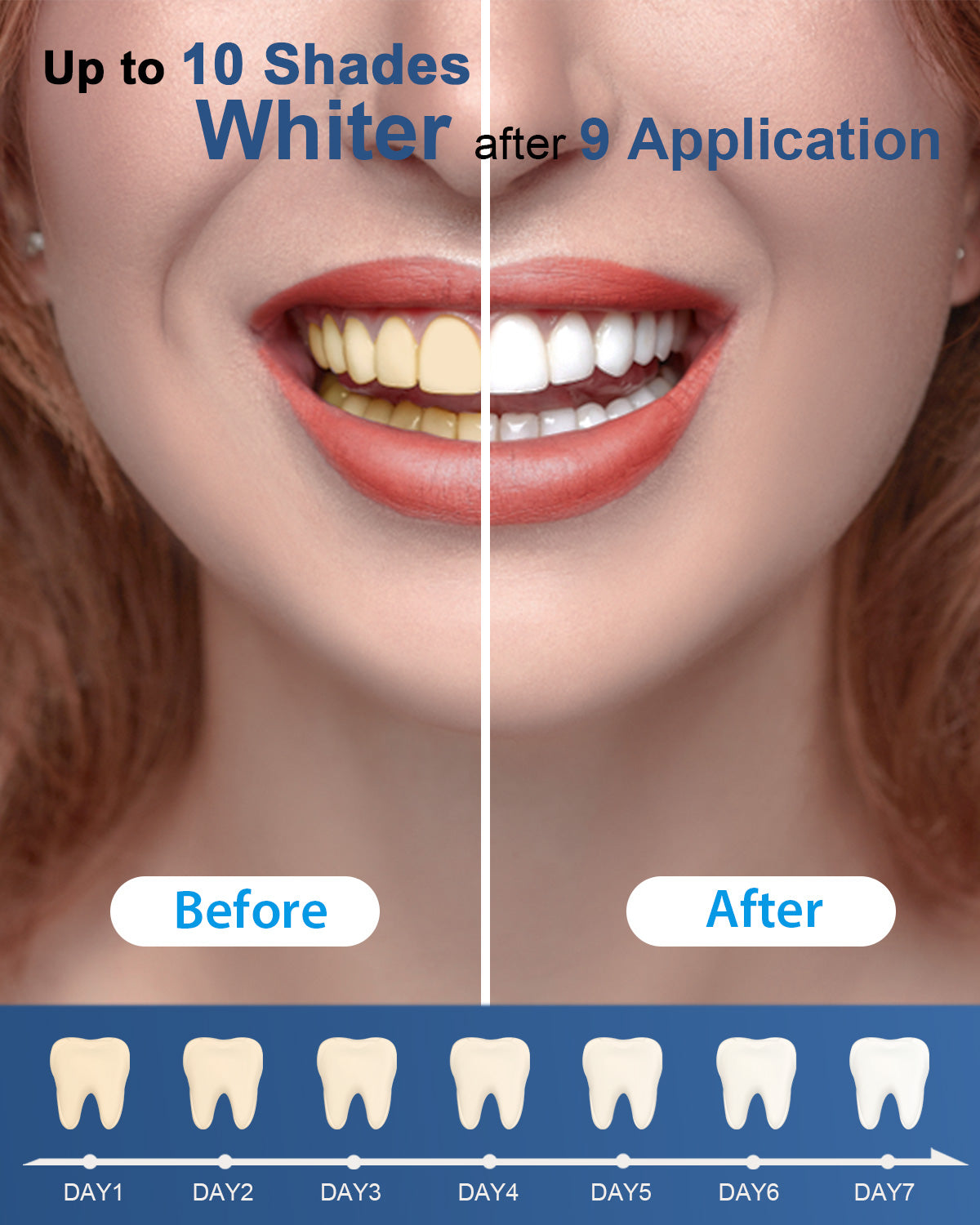 MySmile 2pc 8ml Teeth Whitening Pen Kit,22%CP Teeth Whitening Gel Refill Removes Years Tooth Stains Tooth Whitener 35 Treatments Non Sensitive