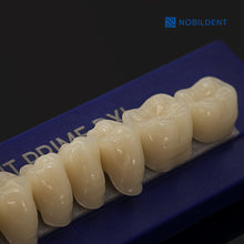 Load image into Gallery viewer, Nobildent Prime DXL Artificial Denture Teeth Posteriors 33°
