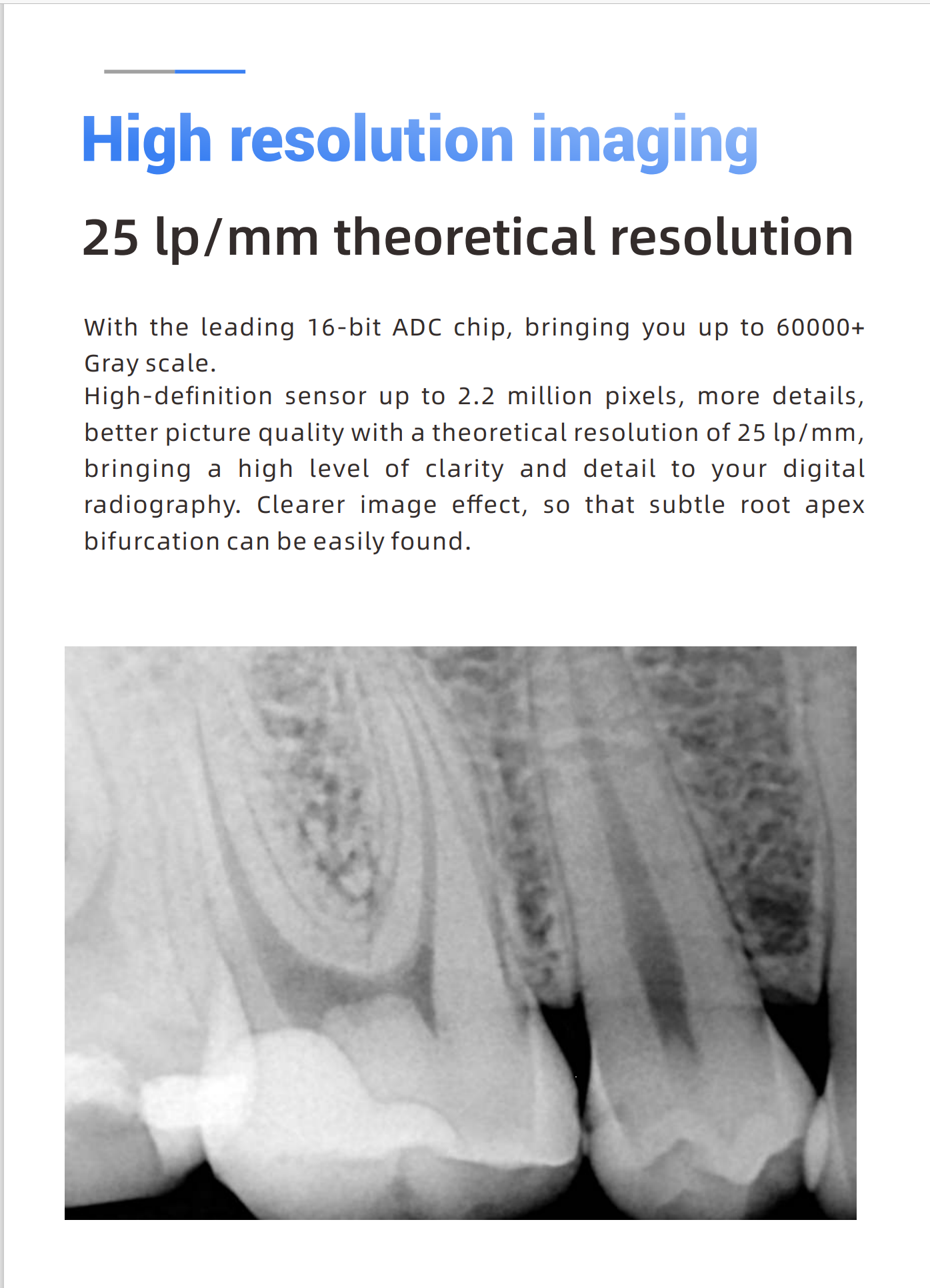 Woodpecker DBA® Intraoral RVG i Sensor H1 H2 Digital X-Ray Sensor w/ free software