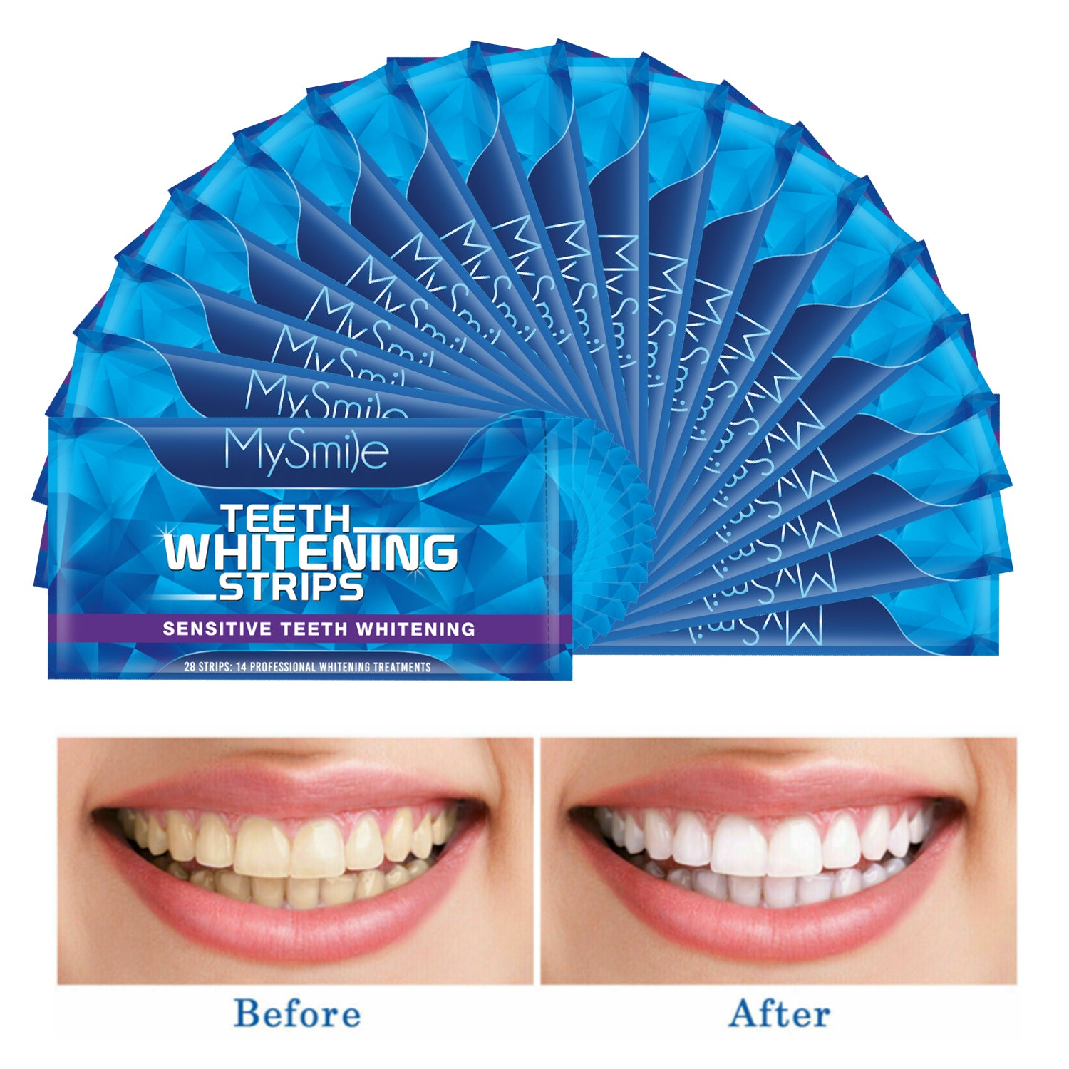 MySmile 35%CP Teeth Whitening Strips, dry white strips