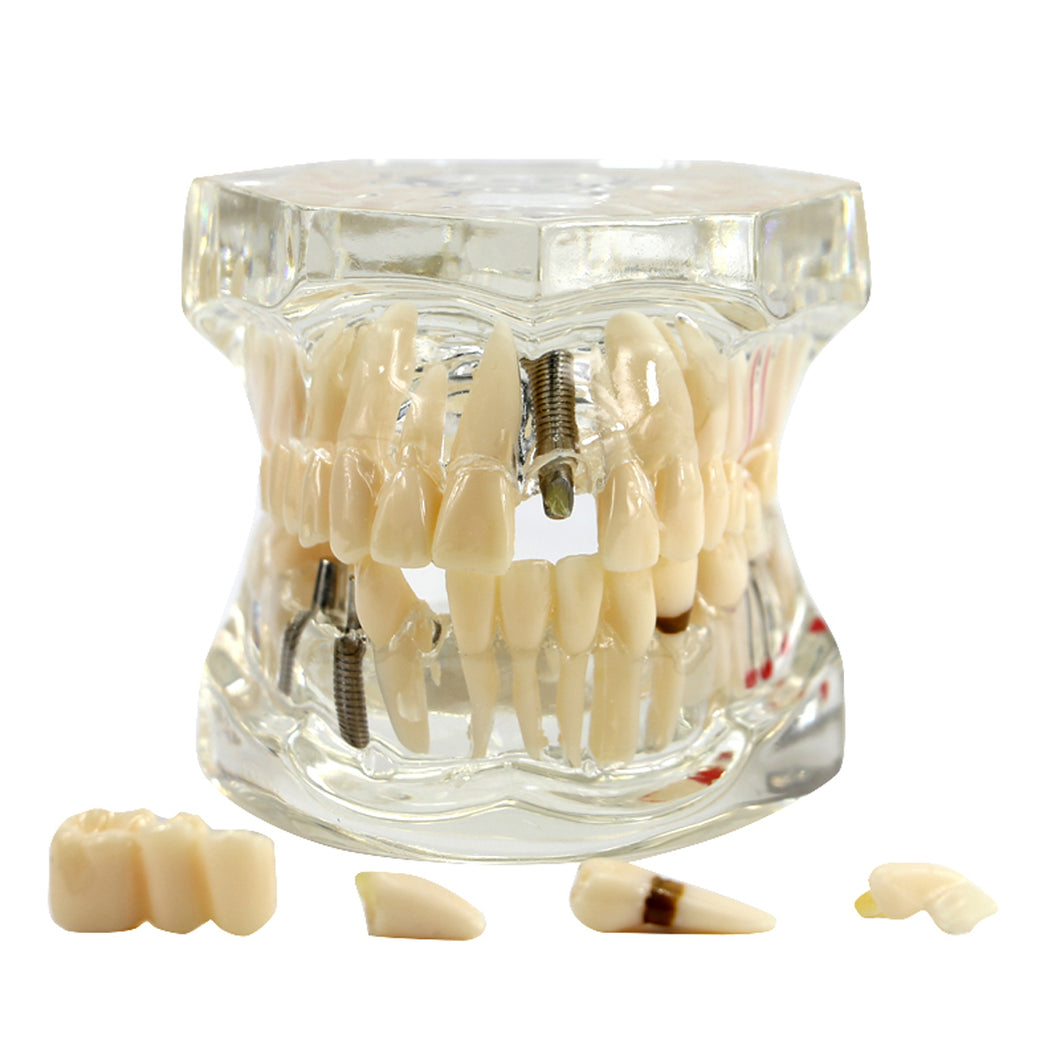 Dental Fake Teeth Study Model 