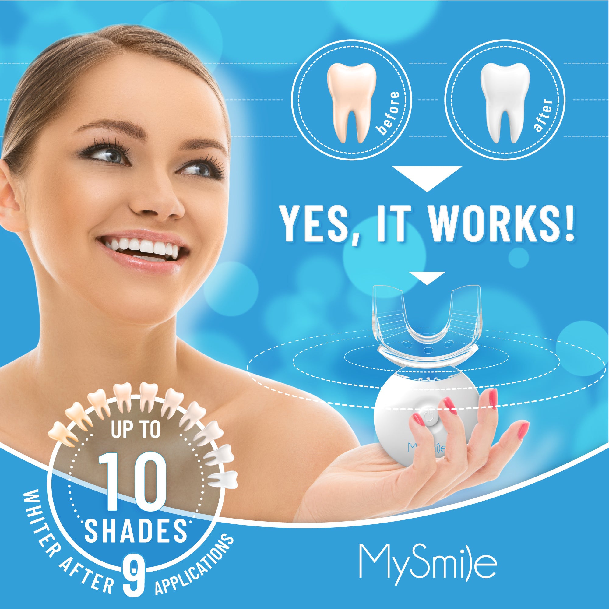 MySmile 35% Carbamide Peroxide Teeth Whitening Kit with Light Tray, 3*3ml Bleaching Gels, Tooth Whitener