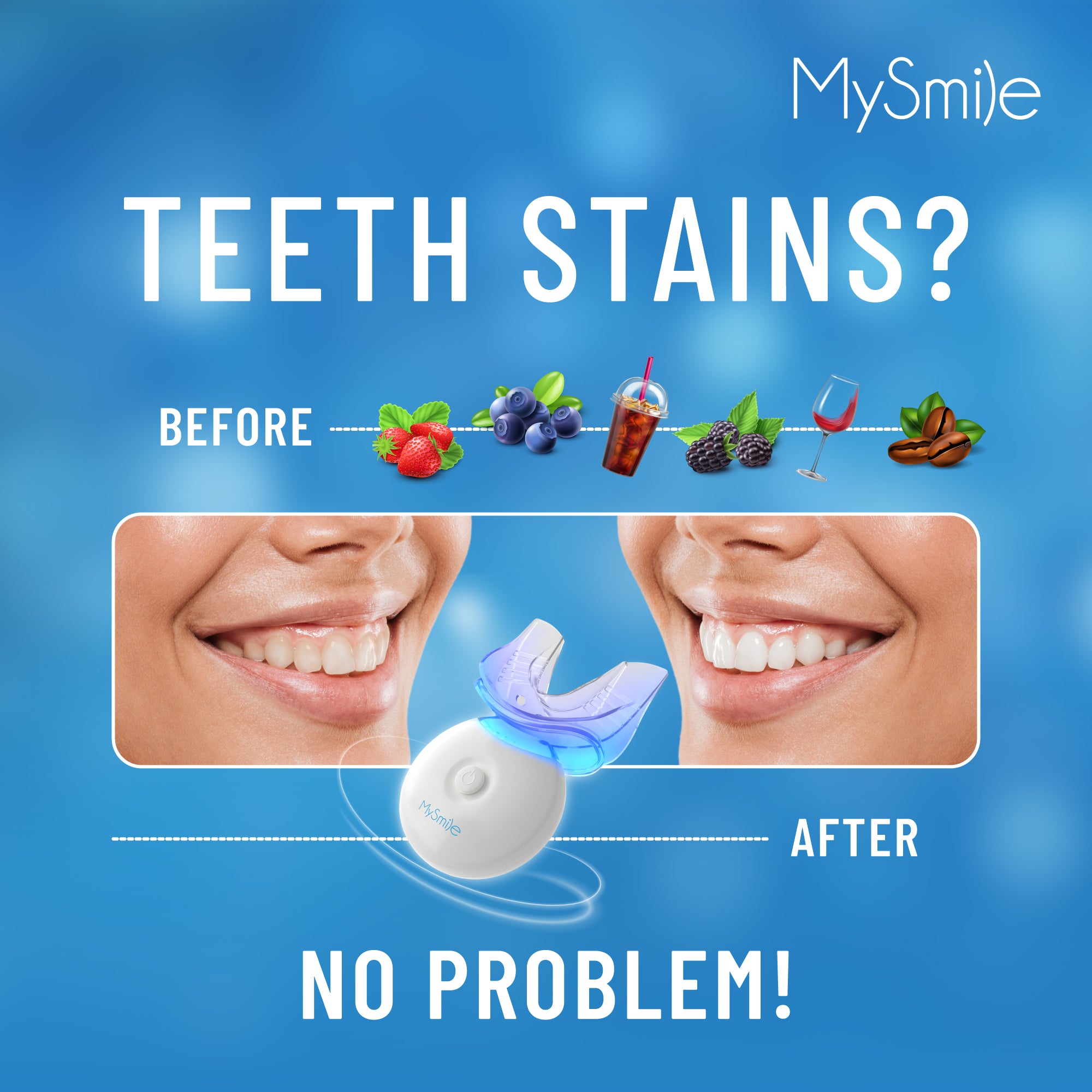 MySmile 35% Carbamide Peroxide Teeth Whitening Kit with Light Tray, 3*3ml Bleaching Gels, Tooth Whitener