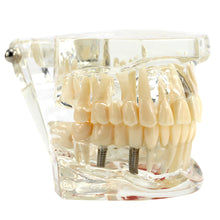 Load image into Gallery viewer, Dental Fake Teeth Study Model 
