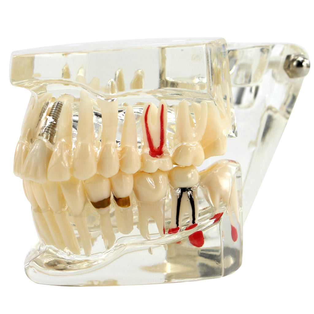 Dental Fake Teeth Study Model 