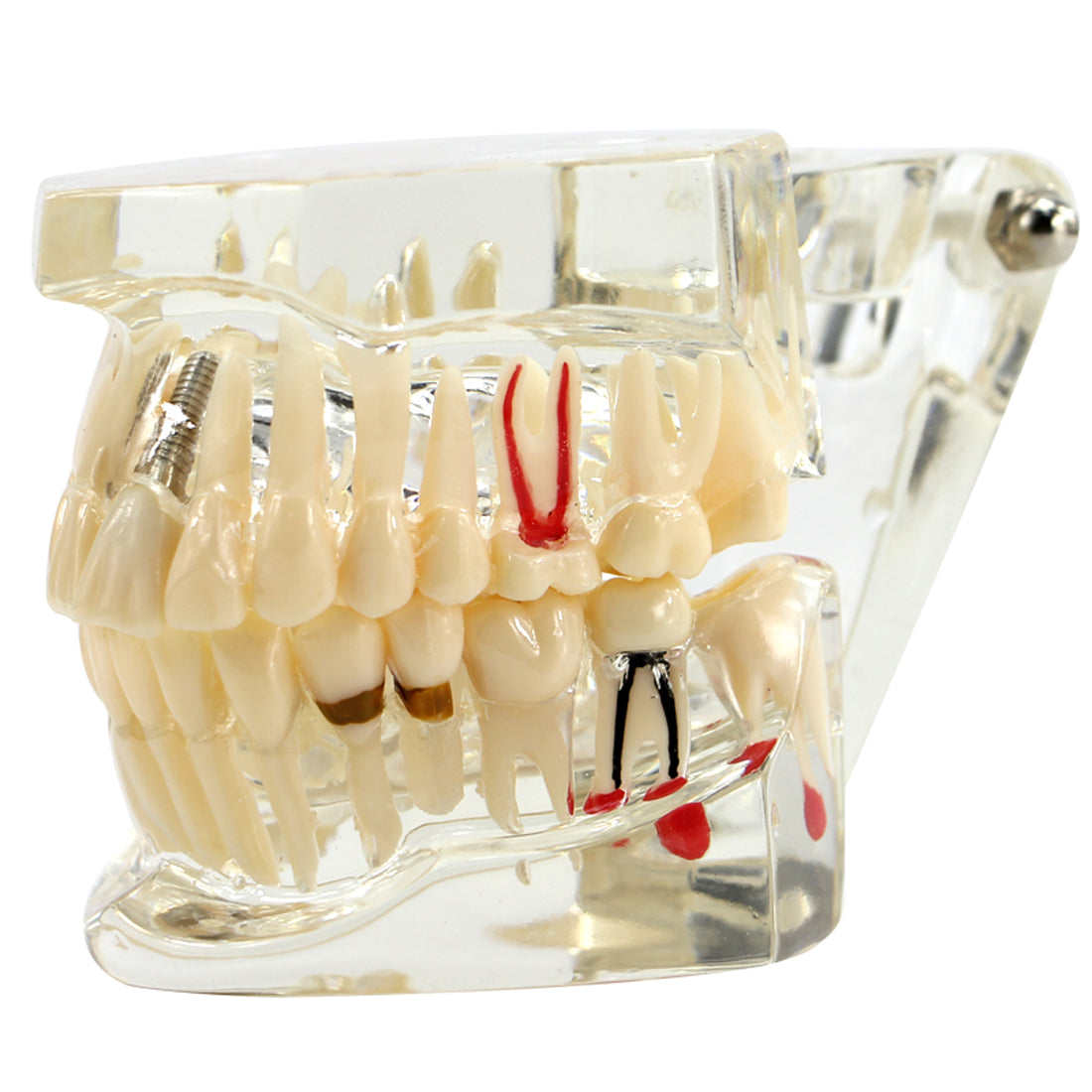 Dental Fake Teeth Study Model 