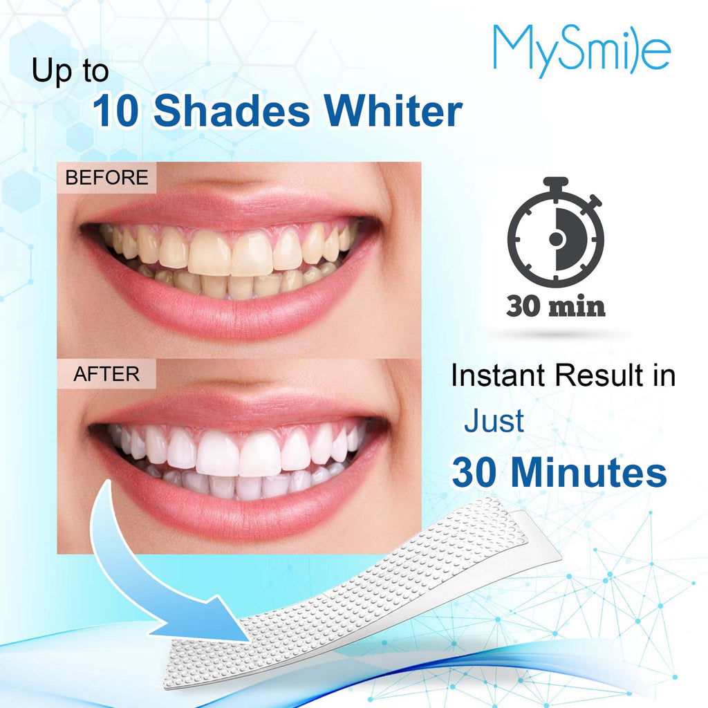 MySmile 6% Hydrogen Peroxide Teeth Whitening Strips (Dry White Strips)