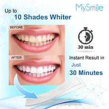 Load image into Gallery viewer, MySmile 6% Hydrogen Peroxide Teeth Whitening Strips (Dry White Strips)
