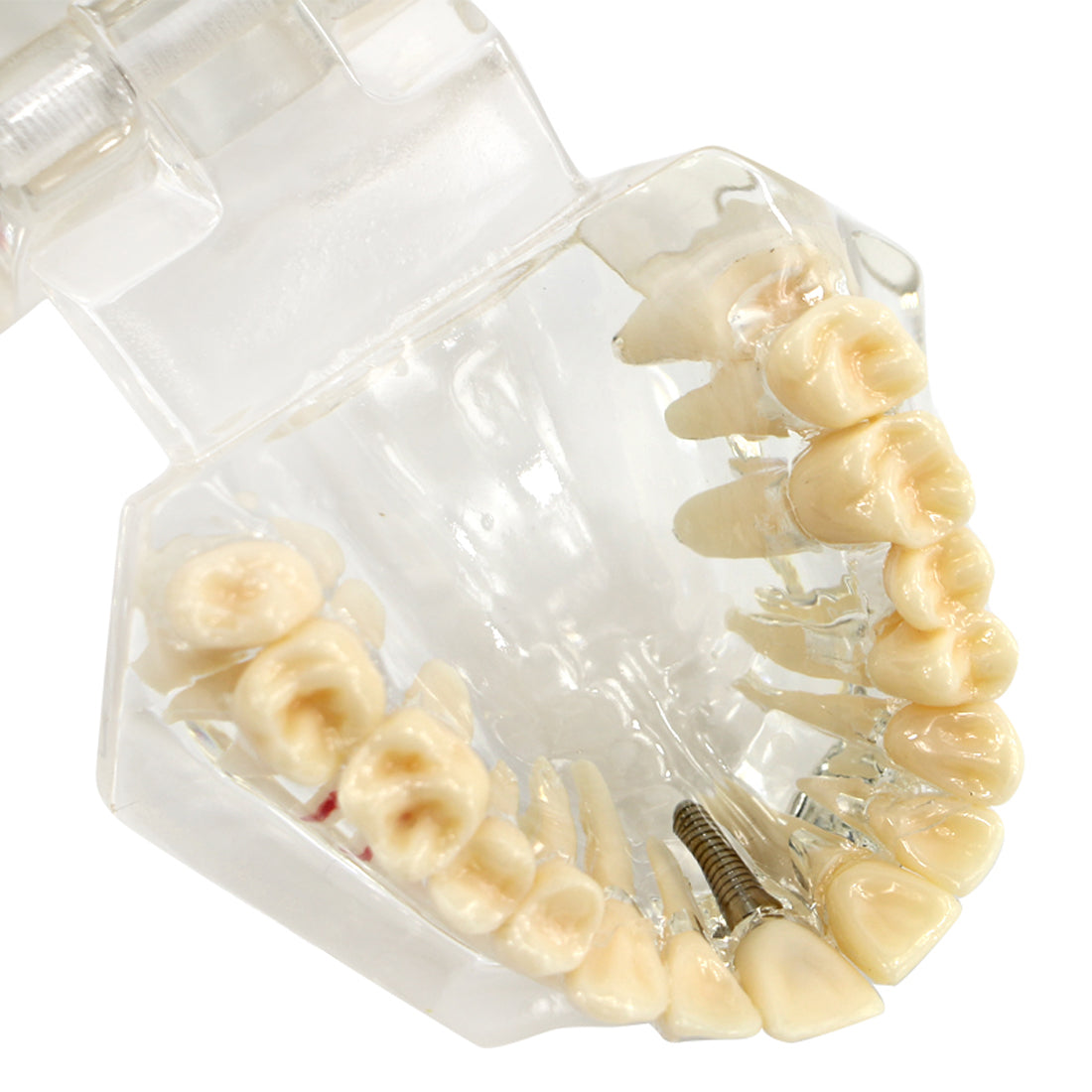 Dental Fake Teeth Study Model 