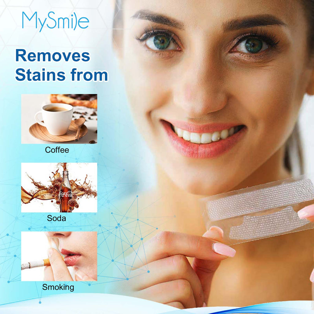 MySmile 6% Hydrogen Peroxide Teeth Whitening Strips (Dry White Strips)