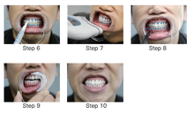 Load image into Gallery viewer, zoom teeth whitening
